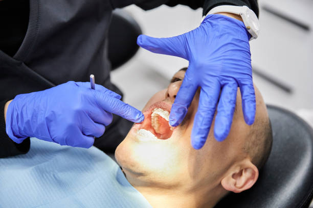 Best Dentist for Tooth Abscess  in West, TX